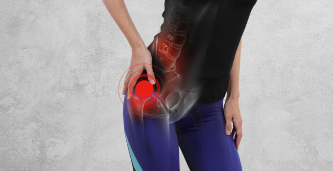 maharasnadi-kashayam-for-hip-pain