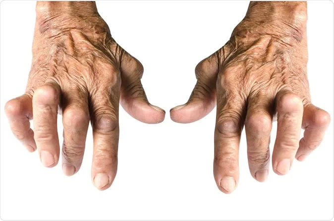 Maharasnadi-kashayam-for-rheumatoid-arthritis