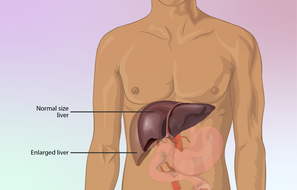 pippalyasavam-ayurvedic-medicine-uses